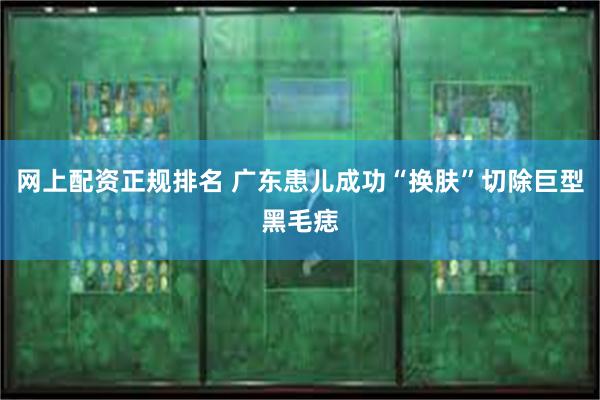 网上配资正规排名 广东患儿成功“换肤”切除巨型黑毛痣